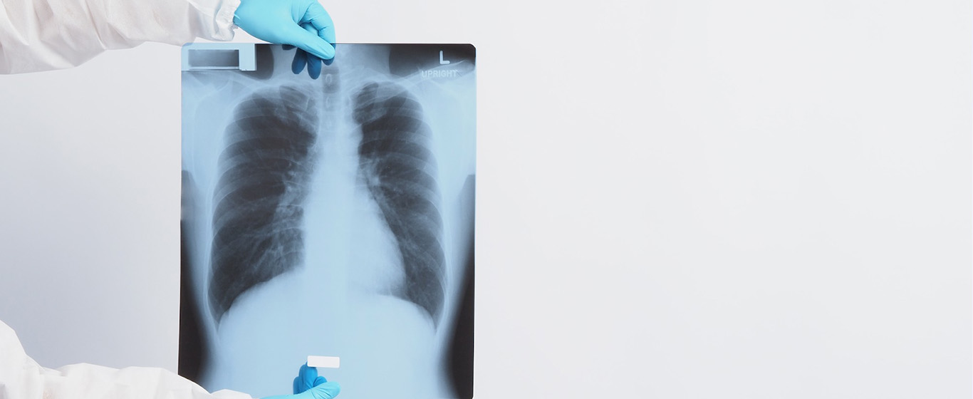 Penyakit Paru Obstruktif Kronis (PPOK): Gejala, Penyebab, Cara Mencegahnya